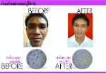 Perfect Melasma Clear Serum ( เพอร์เฟค เมลาสม่า เคลียร์ ซีรั่ม ) 20 ml.